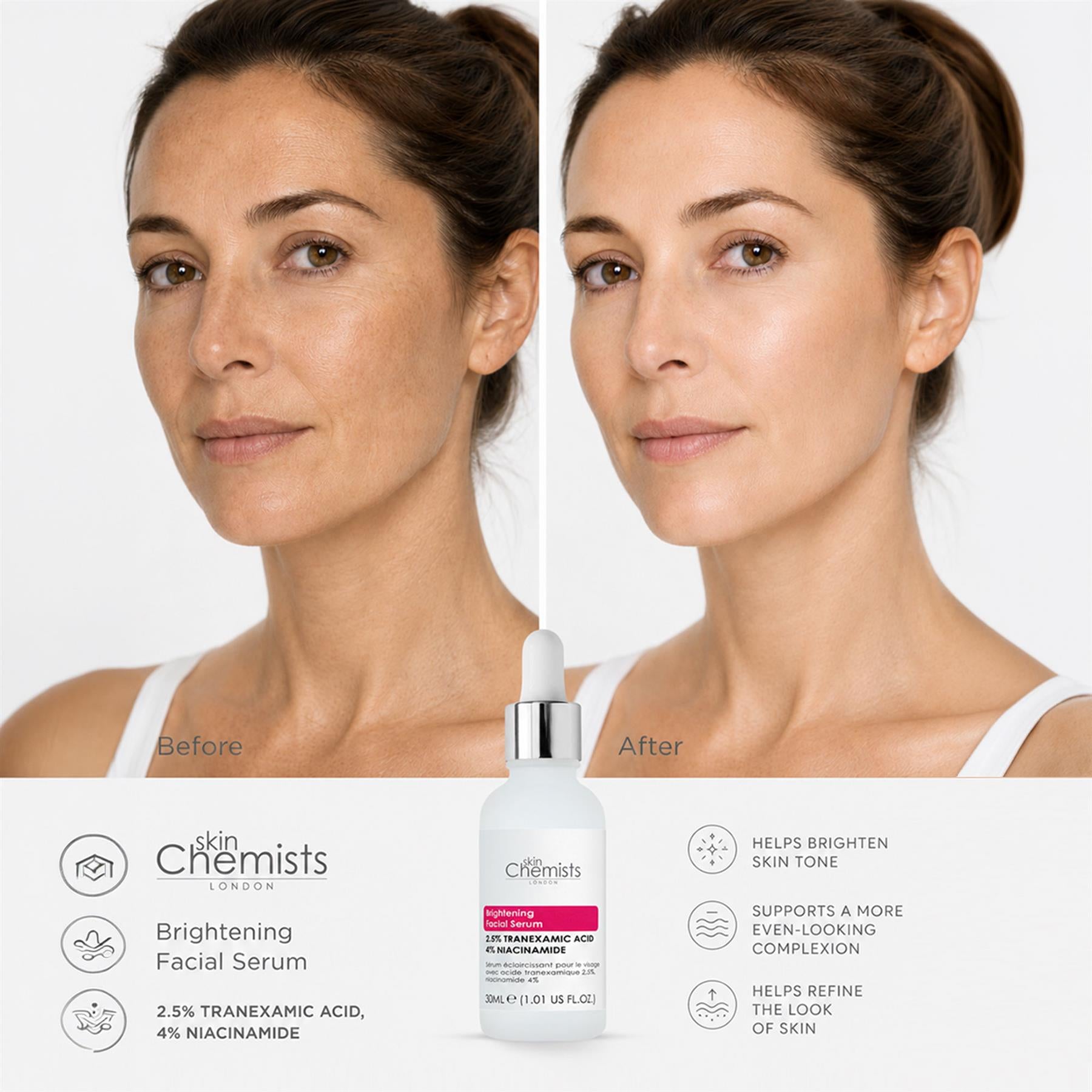 Sérum éclaircissant visage skinChemists à l'acide tranexamique 2,5 % et à la niacinamide 4 % 30 ml
