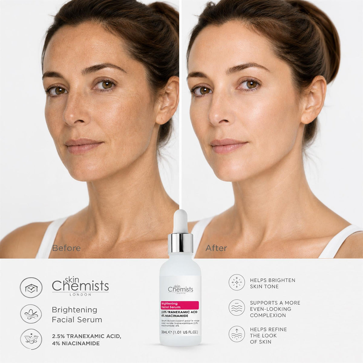 Aufhellendes Gesichtsserum mit 2,5 % Tranexamsäure, 2,5 % Tranexamsäure und 4 % Niacinamid 30ml