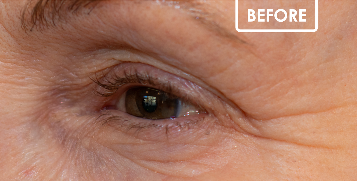 Skincare Routine Graphic