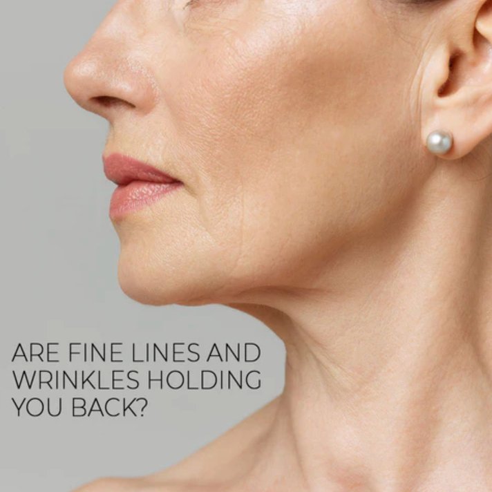 Understanding Fine Lines and Wrinkles - skinChemists