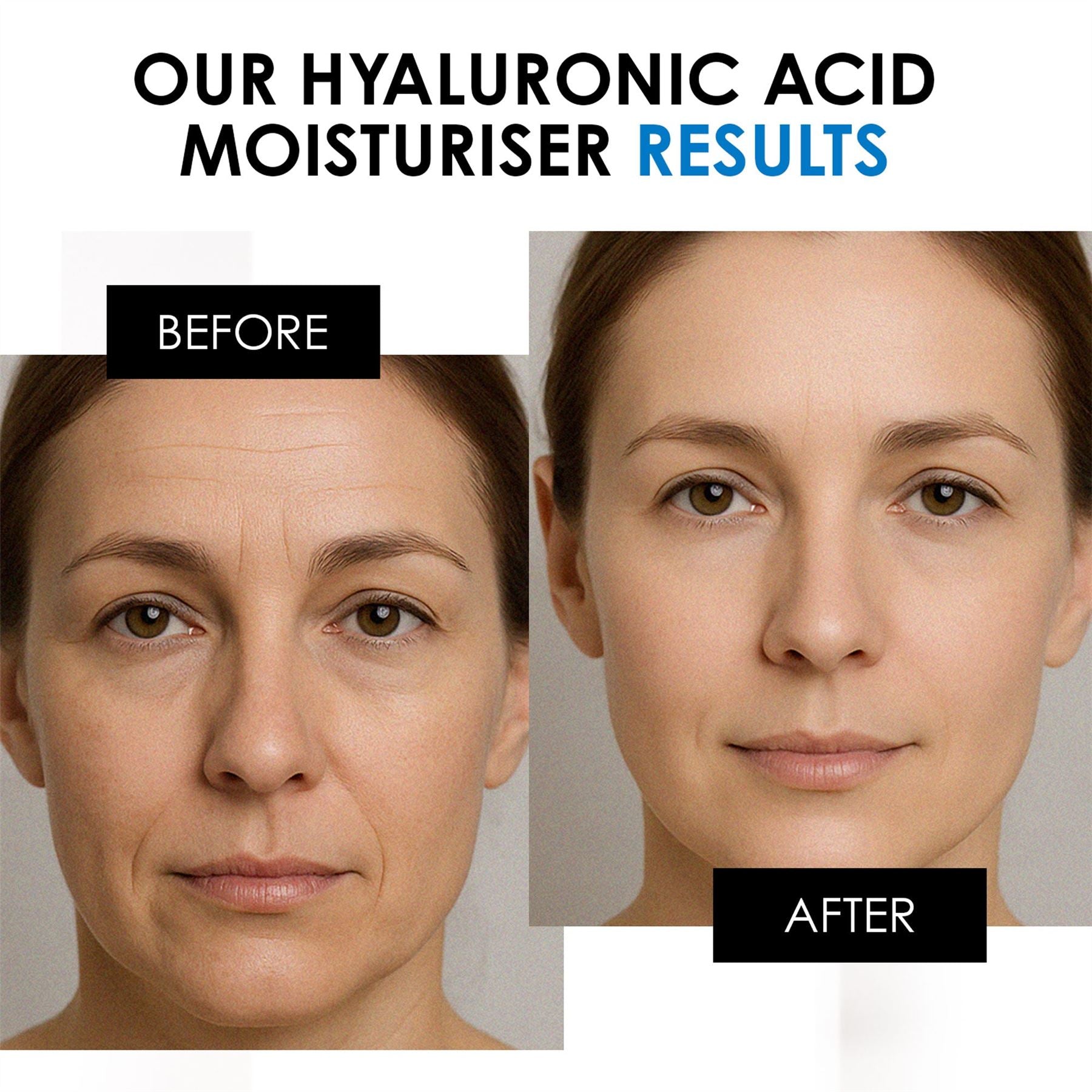 skinChemists Hyaluronic Acid Day Moisturiser 50ml